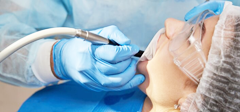 Sinus Lift for Implants