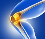 Knee Replacement