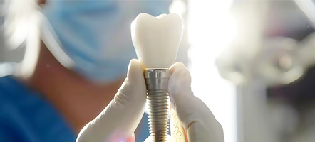 Dental Implants Patient Video