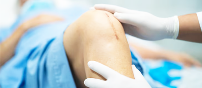 Minimally Invasive Knee Replacement